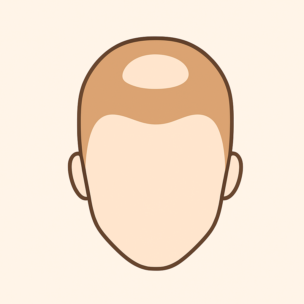 Both Hairline and Crown